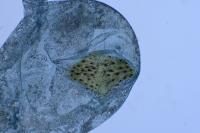 Agnoea