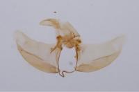 Agnoea