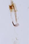 Coleophora serratella