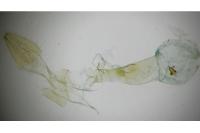 Apatema proteroclina