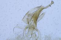 Eteobalea anonymella