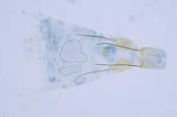 Metzneria hilarella