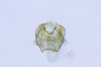 Ectoedemia haraldi