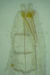 Carpatolechia decorella