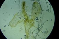 Phyllonorycter insignitella
