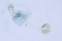 Bucculatrix ulmella