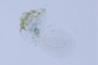 Ectoedemia caradjai