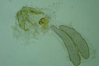 Ectoedemia