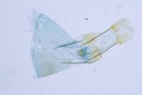 Metzneria hilarella