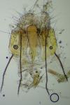 Scythris scopolella