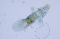Aethes bilbaensis