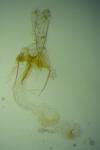 Coleophora texanella