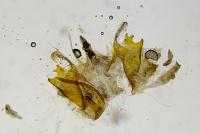 Coleophora striatipennella