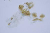 Pammene suspectana