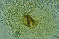 Phyllonorycter messaniella