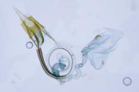 Coleophora versurella