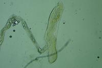 Adaina microdactyla