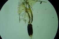 Coleophora lusciniaepennella