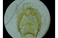 Ectoedemia pubescivora