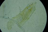 Ectoedemia pubescivora