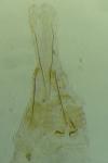 Mompha miscella