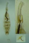 Coleophora brunneosignata