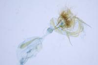 Cnephasia asseclana
