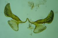 Infurcitinea atrifasciella