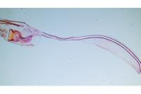 Crassa unitella