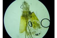 Agnoea josephinae