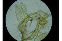 Ectoedemia pubescivora