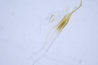 Nematopogon adansoniella