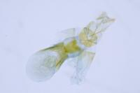 Aethes bilbaensis