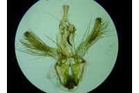 Neofaculta ericetella