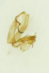 Neofaculta ericetella