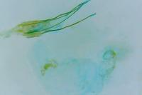 Pyroderces argyrogrammos