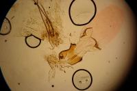 Mompha epilobiella