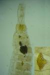 Agnoea josephinae