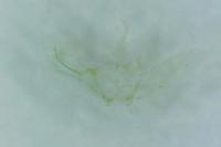 Adaina microdactyla