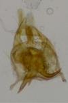 Infurcitinea albicomella