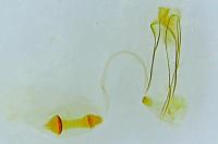 Ypsolopha parenthesella