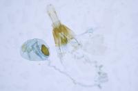 Agnoea flavifrontella