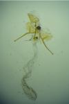 Metzneria paucipunctella