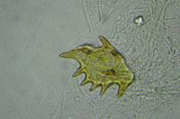 Symmocoides oxybiella