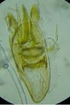 Infurcitinea atrifasciella