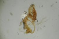 Aproaerema anthyllidella