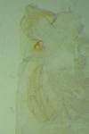Ectoedemia heringi
