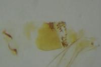 Mompha subbistrigella