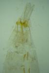 Coleophora texanella