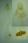Agonopterix scopariella